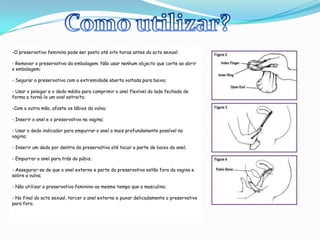 Como utilizar?-O preservativo feminino pode ser postoaté oito horas antes do acto sexual;- Remover o preservativo da embalagem. Não usar nenhum objecto que corte ao abrir a embalagem;- Segurar o preservativo com a extremidade aberta voltada para baixo;- Usar o polegar e o dedo médio para comprimir o anel flexível do lado fechado de forma a torná-lo um oval estreito;-Com a outra mão, afaste os lábios da vulva;- Inserir o anel e o preservativo na vagina;- Usar o dedo indicador para empurrar o anel o mais profundamente possível na vagina;- Inserir um dedo por dentro do preservativo até tocar a parte de baixo do anel;- Empurrar o anel para trás do púbis;- Assegurar-se de que o anel externo e parte do preservativo estão fora da vagina e sobre a vulva;- Não utilizar o preservativo feminino ao mesmo tempo que o masculino;- No final do acto sexual, torcer o anel externo e puxar delicadamente o preservativo para fora. 