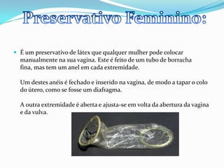 É um preservativo de látex que qualquer mulher pode colocar manualmente na sua vagina. Este é feito de um tubo de borracha fina, mas tem um anel em cada extremidade. Um destes anéis é fechado e inserido na vagina, de modo a tapar o colo do útero, como se fosse um diafragma.A outra extremidade é aberta e ajusta-se em volta da abertura da vagina e da vulva. Preservativo Feminino:  