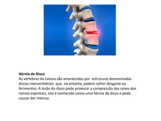 Hérnia de Disco
As vértebras da coluna são amortecidas por estruturas denominadas
discos intervertebrais que, no entanto, podem sofrer desgaste ou
ferimentos. A lesão do disco pode provocar a compressão das raízes dos
nervos espinhais, isto é conhecido como uma hérnia de disco e pode
causar dor intensa.
 