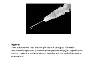 Injeções
Se os tratamentos mais simples por via oral ou tópica não estão
funcionando é possivel que seu médico prescreva injeções seja de forma
local ou sistémica, normalmente as injeções utilizam antiinflamatórios
esteroideos.
 