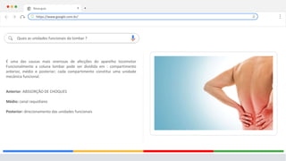Nova guia X +
Quais as unidades funcionais da lombar ?
É uma das causas mais onerosas de afecções do aparelho locomotor
Funcionalmente a coluna lombar pode ser dividida em : compartimento
anterior, médio e posterior; cada compartimento constitui uma unidade
mecânica funcional.
Anterior: ABSSORÇÃO DE CHOQUES
Médio: canal raquidiano
Posterior: direcionamento das unidades funcionais
https://www.google.com.br/
 