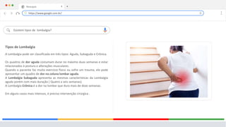 Nova guia X +
Existem tipos de lombalgia?
Tipos de Lombalgia
A Lombalgia pode ser classificada em três tipos: Aguda, Subaguda e Crônica.
Os quadros de dor aguda costumam durar no máximo duas semanas e estar
relacionados à postura e alterações musculares.
Quando o paciente faz muito exercício físico ou sofre um trauma, ele pode
apresentar um quadro de dor na coluna lombar aguda.
A Lombalgia Subaguda apresenta as mesmas características da Lombalgia
aguda porém com mais duração ( Quatro a seis semanas).
A Lombalgia Crônica é a dor na lombar que dura mais de doze semanas.
Em alguns casos mais intensos, é preciso intervenção cirúrgica .
https://www.google.com.br/
 