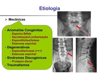 Etiologia
 Mecânicas
 Inflamatórias
 Infecciosas
 Metabólicas
 Tumorais
 Dor Visceral Referida
Coluna Lombar
- Anomalias Congénitas
- Espinha Bífida
- Sacralização/Lombarização
- Espondilolise/listese
- Estenose espinhal
- Degenerativas
- Espondilartroses (+++)
- Estenose espinhal
- Sindromes Discogénicos
- Prolapso discal
- Traumatismos
1
2 3
 