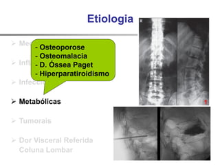 Etiologia
 Mecânicas
 Inflamatórias
 Infecciosas
 Metabólicas
 Tumorais
 Dor Visceral Referida
Coluna Lombar
- Osteoporose
- Osteomalacia
- D. Óssea Paget
- Hiperparatiroidismo
1
 