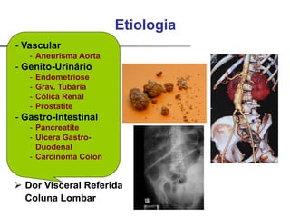 Etiologia
 Mecânicas
 Inflamatórias
 Infecciosas
 Metabólicas
 Tumorais
 Dor Visceral Referida
Coluna Lombar
- Vascular
- Aneurisma Aorta
- Genito-Urinário
- Endometriose
- Grav. Tubária
- Cólica Renal
- Prostatite
- Gastro-Intestinal
- Pancreatite
- Ulcera Gastro-
Duodenal
- Carcinoma Colon
 