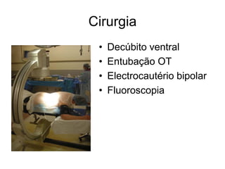 Cirurgia
• Decúbito ventral
• Entubação OT
• Electrocautério bipolar
• Fluoroscopia
 
