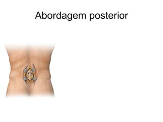 Abordagem posterior
 