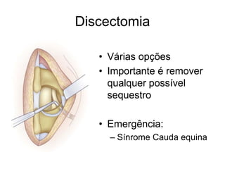 Discectomia
• Várias opções
• Importante é remover
qualquer possível
sequestro
• Emergência:
– Sínrome Cauda equina
 