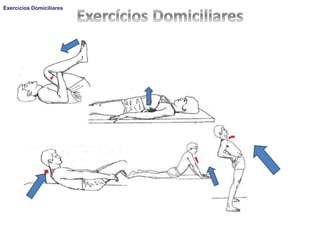 Exercícios Domiciliares
 