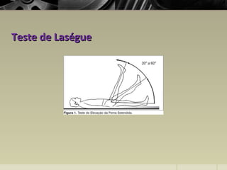 Teste de LaségueTeste de Laségue
 