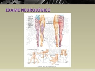 EXAME NEUROLÓGICO
 
