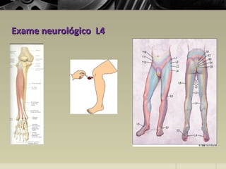 Exame neurológico L4Exame neurológico L4
 