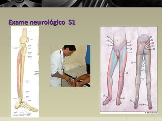 Exame neurológico S1Exame neurológico S1
 