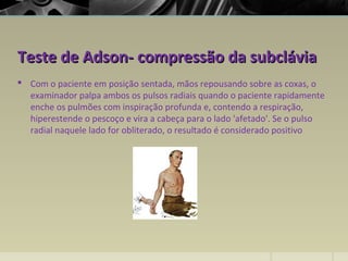 Teste de Adson- compressão da subcláviaTeste de Adson- compressão da subclávia
 Com o paciente em posição sentada, mãos repousando sobre as coxas, o
examinador palpa ambos os pulsos radiais quando o paciente rapidamente
enche os pulmões com inspiração profunda e, contendo a respiração,
hiperestende o pescoço e vira a cabeça para o lado 'afetado'. Se o pulso
radial naquele lado for obliterado, o resultado é considerado positivo
 