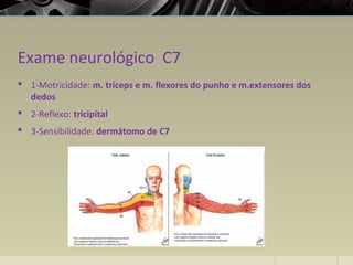Exame neurológico C7
 1-Motricidade: m. tríceps e m. flexores do punho e m.extensores dos
dedos
 2-Reflexo: tricipital
 3-Sensibilidade: dermátomo de C7
 