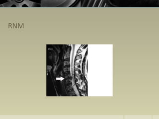RNM
 