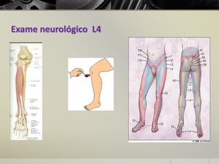 Exame neurológico L4
 