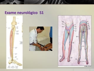 Exame neurológico S1
 