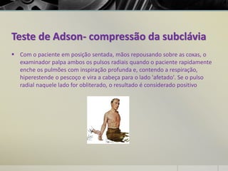 Teste de Adson- compressão da subclávia
▪ Com o paciente em posição sentada, mãos repousando sobre as coxas, o
examinador palpa ambos os pulsos radiais quando o paciente rapidamente
enche os pulmões com inspiração profunda e, contendo a respiração,
hiperestende o pescoço e vira a cabeça para o lado 'afetado'. Se o pulso
radial naquele lado for obliterado, o resultado é considerado positivo
 