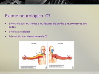 Exame neurológico C7
▪ 1-Motricidade: m. tríceps e m. flexores do punho e m.extensores dos
dedos
▪ 2-Reflexo: tricipital
▪ 3-Sensibilidade: dermátomo de C7
 