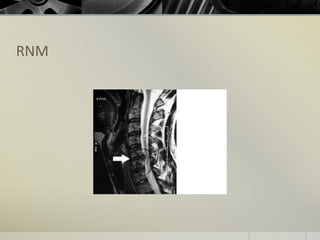 RNM
 