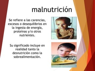 malnutrición
Se refiere a las carencias,
excesos o desequilibrios en
la ingesta de energía,
proteínas y/o otros
nutrientes.
Su significado incluye en
realidad tanto la
desnutrición como la
sobrealimentación.
 