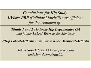 Conclusions for Hip Study
1/Visco-PRP (Cellular MatrixTM
) was efficient
for the treatment of
 