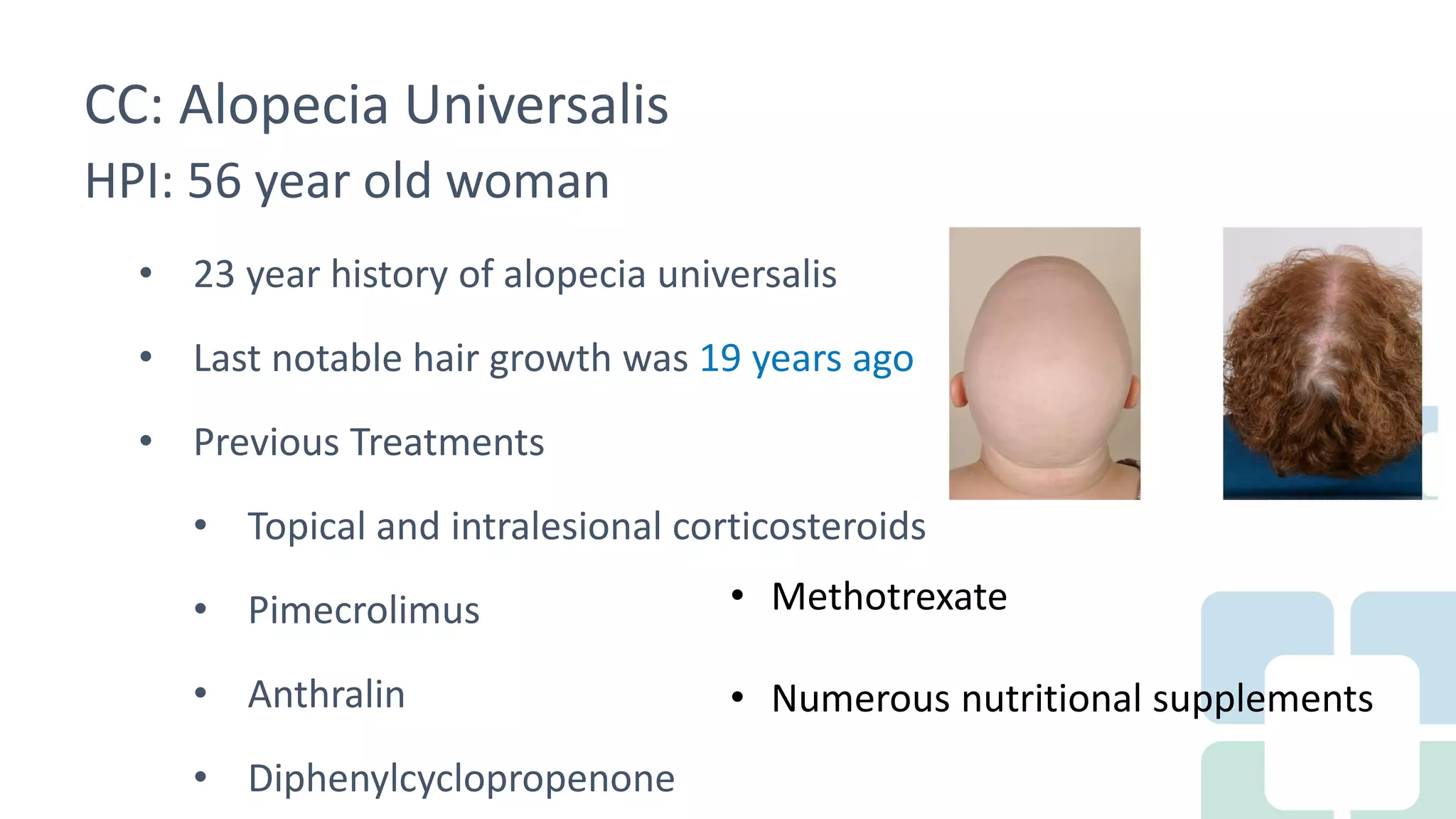 Long Term Treatment for Severe Alopecia Areata with Oral Tofacitinib ...