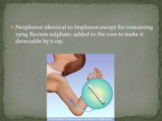  Nexplanon identical to Implanon except for containing
15mg Barium sulphate, added to the core to make it
detectable by x-ray.
 
