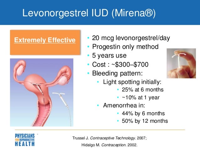 mirena levonorgestrel cost