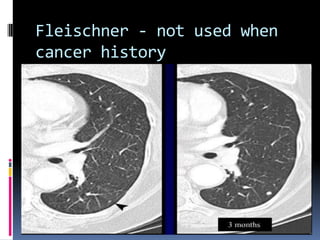 Fleischner - not used when
cancer history
 