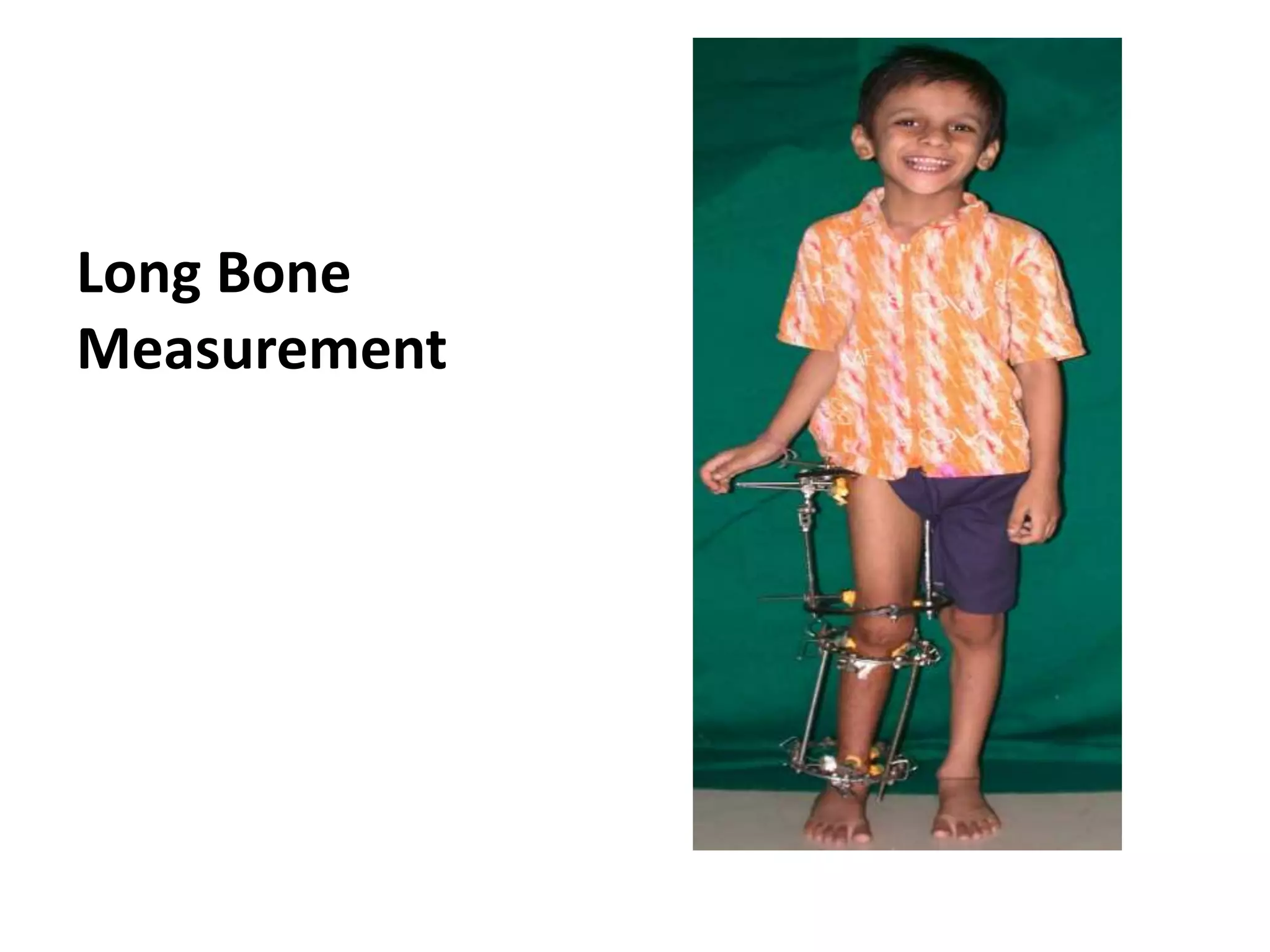 Long Bone Study Ruler Long bone measurement | PPTX