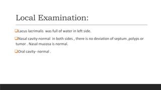 Local Examination:
Lacus lacrimalis was full of water in left side.
Nasal cavity-normal in both sides , there is no deviation of septum ,polyps or
tumor . Nasal mucosa is normal.
Oral cavity- normal .
 