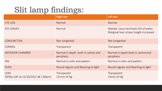Slit lamp findings:
Right eye Left eye
EYE LIDS Normal Normal
EYE LASHES Normal Matted. Lacus lacrimalis full of water.
Marginal tear stripes height increased
CONJUNCTIVA Not congested Not congested
CORNEA Transparent Transparent
ANTERIOR CHAMBER Normal in depth both in centre and
periphery
Normal in depth both in centre and
periphery
IRIS Normal in color and pattern Normal in color and pattern
PUPIL Round regular and Reacting to light Round regular and Reacting to light
LENS
IOP(by GAT at 12/10/2021 @ 1.06pm)
Transparent
14 mm of Hg
Transparent
14mm of Hg
 