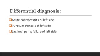 Differential diagnosis:
Acute dacryocystitis of left side
Punctum stenosis of left side
Lacrimal pump failure of left side
 