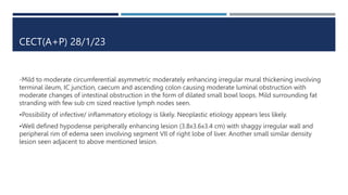 Long Case RIF masss.pptx