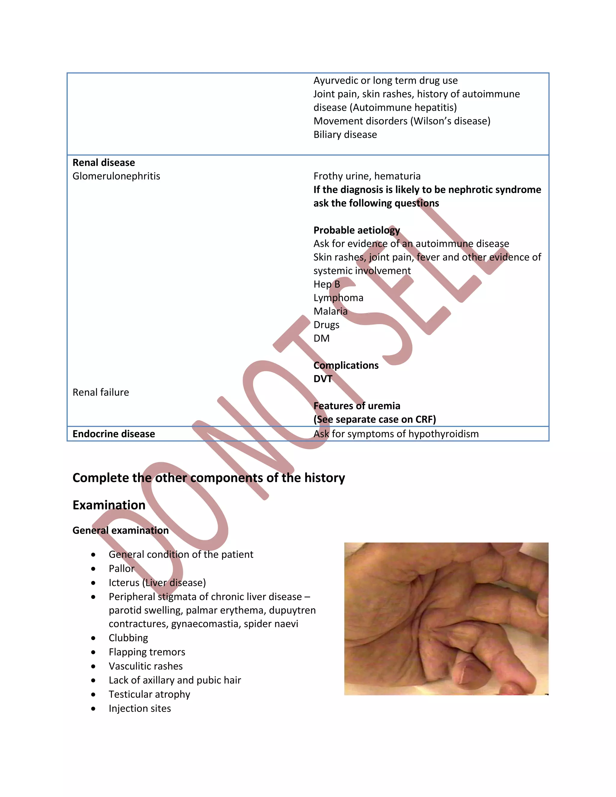 Ayurvedic or long term drug use
Joint pain, skin rashes, history of autoimmune
disease (Autoimmune hepatitis)
Movement disorders (Wilson’s disease)
Biliary disease
Renal disease
Glomerulonephritis
Renal failure
Frothy urine, hematuria
If the diagnosis is likely to be nephrotic syndrome
ask the following questions
Probable aetiology
Ask for evidence of an autoimmune disease
Skin rashes, joint pain, fever and other evidence of
systemic involvement
Hep B
Lymphoma
Malaria
Drugs
DM
Complications
DVT
Features of uremia
(See separate case on CRF)
Endocrine disease Ask for symptoms of hypothyroidism
Complete the other components of the history
Examination
General examination
 General condition of the patient
 Pallor
 Icterus (Liver disease)
 Peripheral stigmata of chronic liver disease –
parotid swelling, palmar erythema, dupuytren
contractures, gynaecomastia, spider naevi
 Clubbing
 Flapping tremors
 Vasculitic rashes
 Lack of axillary and pubic hair
 Testicular atrophy
 Injection sites
 
