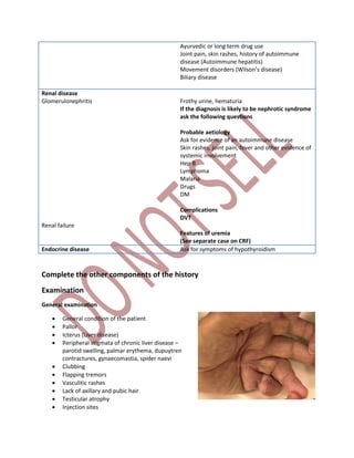 Ayurvedic or long term drug use
Joint pain, skin rashes, history of autoimmune
disease (Autoimmune hepatitis)
Movement disorders (Wilson’s disease)
Biliary disease
Renal disease
Glomerulonephritis
Renal failure
Frothy urine, hematuria
If the diagnosis is likely to be nephrotic syndrome
ask the following questions
Probable aetiology
Ask for evidence of an autoimmune disease
Skin rashes, joint pain, fever and other evidence of
systemic involvement
Hep B
Lymphoma
Malaria
Drugs
DM
Complications
DVT
Features of uremia
(See separate case on CRF)
Endocrine disease Ask for symptoms of hypothyroidism
Complete the other components of the history
Examination
General examination
 General condition of the patient
 Pallor
 Icterus (Liver disease)
 Peripheral stigmata of chronic liver disease –
parotid swelling, palmar erythema, dupuytren
contractures, gynaecomastia, spider naevi
 Clubbing
 Flapping tremors
 Vasculitic rashes
 Lack of axillary and pubic hair
 Testicular atrophy
 Injection sites
 