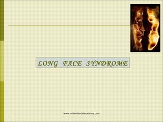 LONG FACE SYNDROME

www.indiandentalacademy.com

 