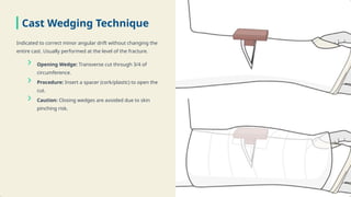 Comprehensive Guide to Long Leg Cast Management for Tibial Fractures | PPTX