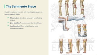 Comprehensive Guide to Long Leg Cast Management for Tibial Fractures | PPTX