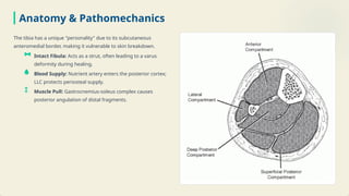 Comprehensive Guide to Long Leg Cast Management for Tibial Fractures | PPTX