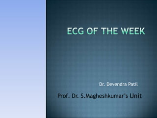 ECG of the week ,[object Object],Prof.Dr. S.Magheshkumar’sUnit 
