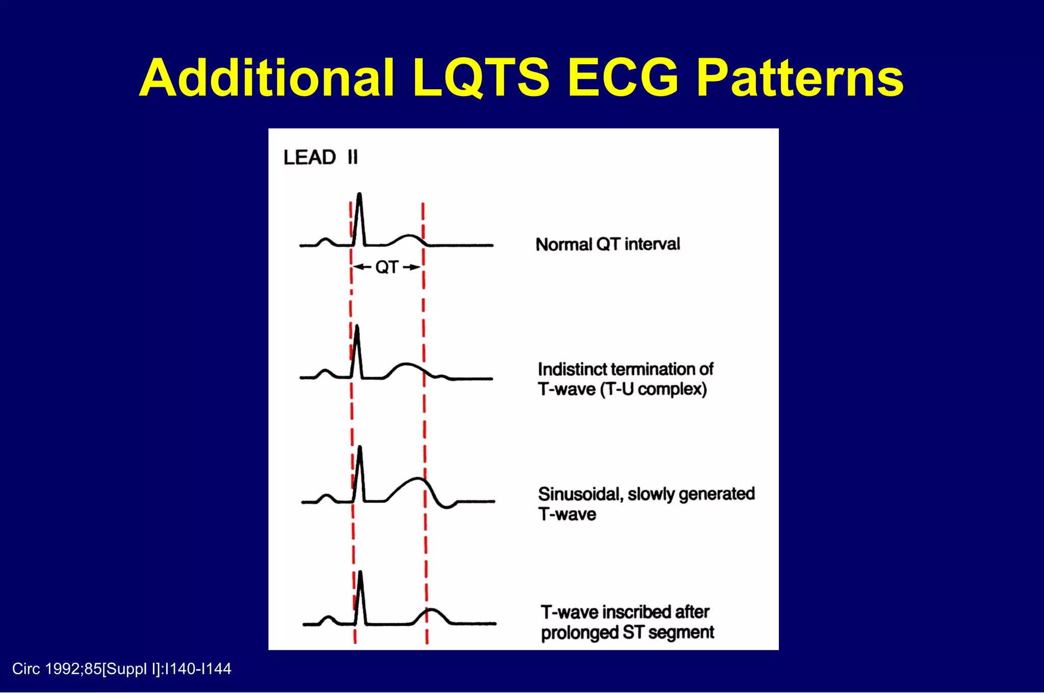 Additional LQTS ECG Patterns Circ 1992;85[Suppl I]:I140-I144 