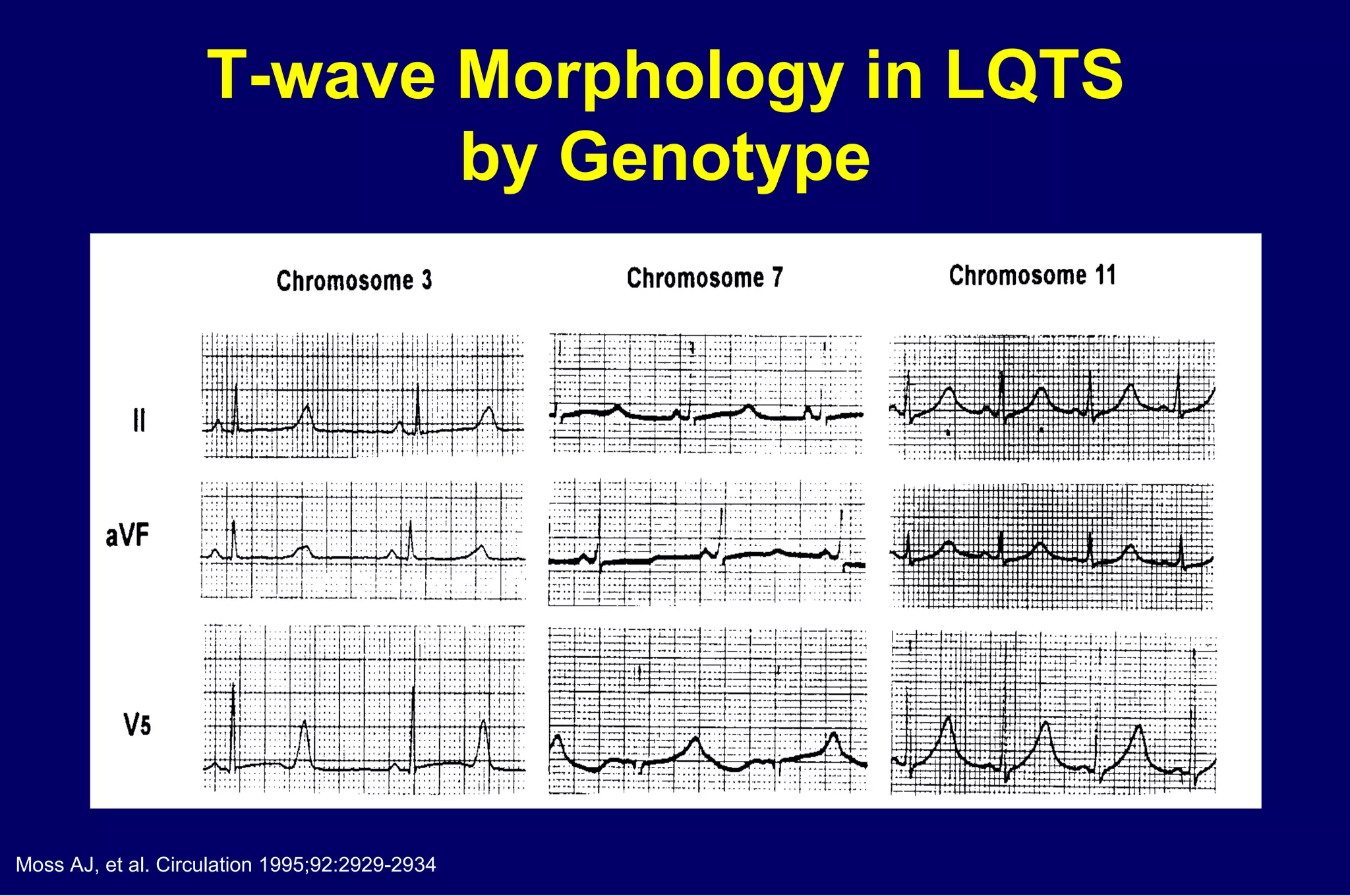 T-wave Morphology in LQTS  by Genotype  Moss AJ, et al. Circulation 1995;92:2929-2934 