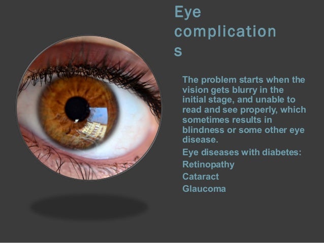 Optic Nerve and Glaucoma