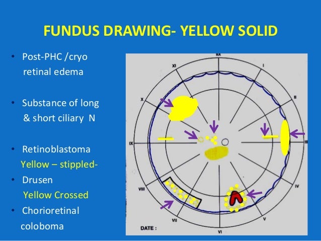 Featured image of post Normal Fundus Drawing / National eye institute, national institutes of health.