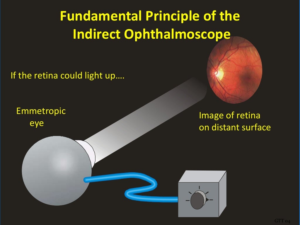 Looking deep into retina indirect ophthalmoscopy and fundus drawing