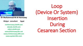 Loop
(Device Or System)
Insertion
During
Cesarean Section
Dr Muhammad M Al Hennawy
Ob/gyn consultant Egypt
mmhennawy.site44.com
ekotob.site44.com
rebch.site44.com
www.drhennawy.8m.net
www.mmhennawy.20fr.com
www.ayolab.20m.com
 
