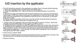 Loop (device orsystem) insertion during cesarean section | PPTX